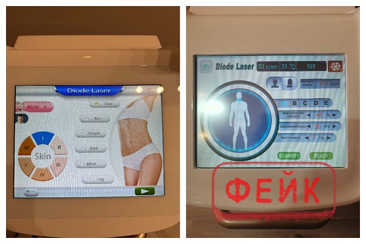 Подделки лазерных эпиляторов MAYER представляют собой серьезную проблему для рынка